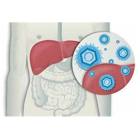 丙型肝炎（HCV）