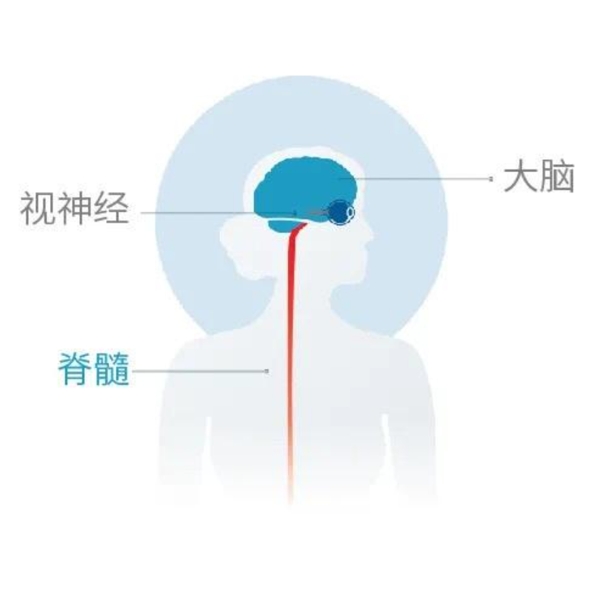 视神经脊髓炎谱系障碍(NMOSD)
