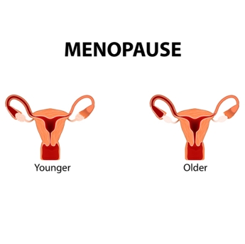 更年期（Menopause）
